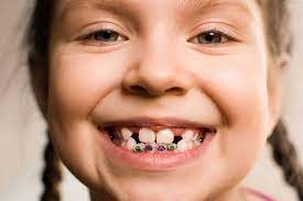 Getting Braces Chat online, Orthodontist Treatment Info